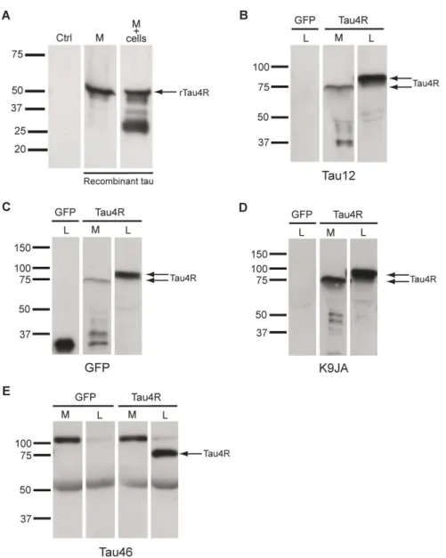 Figure 4. Secreted tau is cleaved at the C-terminal. (A) Full-length recombinant human tau  protein (rTau4R) was still detectable in the culture medium after being added to control Hela  cells for 48 hrs (arrow, M+cells)