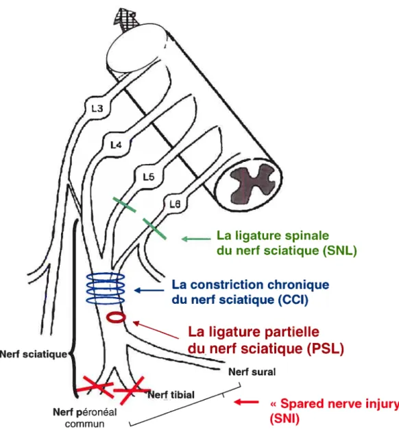 Figure 12 Les principaux modèles de douleur neuropathique: la ligature spinale L5, L6 (le modèle Chung): la constriction chronique (le modèle Bennett): la ligature partielle du nerf sciatique (modèle Seltzer); le modèle Decosterd (« spared nerve