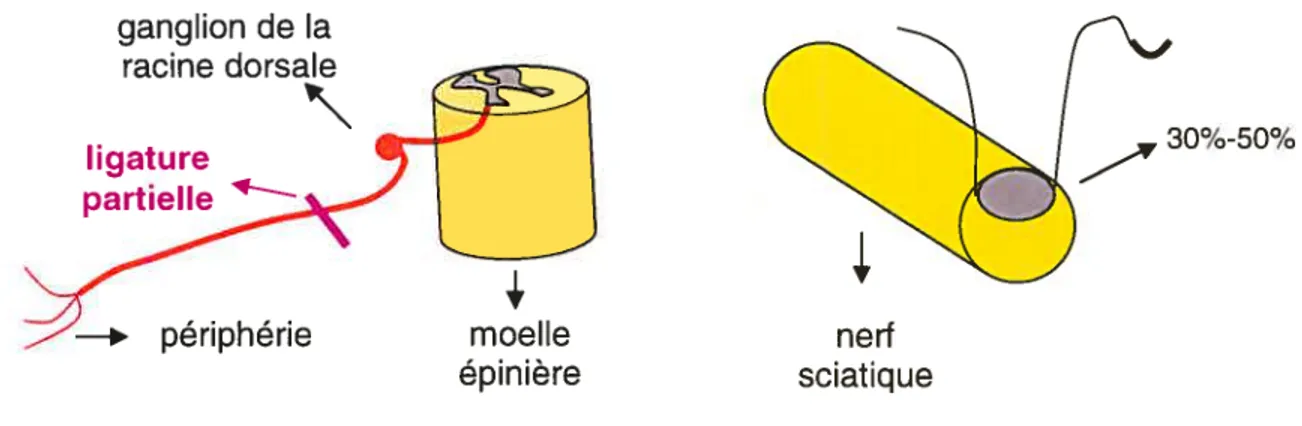 Figure 13 Le modèle de Seltzer (la ligature partielle du nerf sciatique) ligature partielle et serrée de 30 à 50% de la circonférence du nerf sciatique (voir aussi Figure 12)