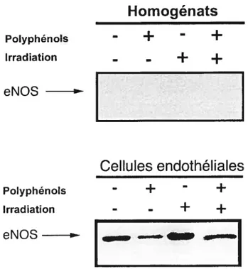 Fig 3.3 Détection de l’expression d’eNOS dans l’homogénat de tissu tumoral et des cellules endothéliales isolées des groupes témoin, polyphénols, traité aux polyphénols, irradié et irradié avec polyphénols