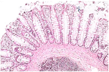 figure 1 : Cryptes épithéliales présentes dans un intestin normal.