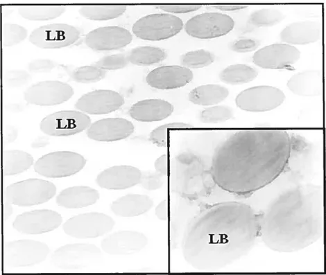 Fig 8. Image de la pureté des phagosornes isolés. Microscopie électronique (12 000x et 50 000x pour l’encadré) d’une isolation de billes de latex (LB) 0,8 tm phagocytées sur gradient de sucrose (62 ¾ à 10 ¾)