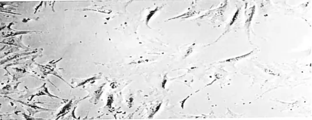 figure B Light microscopic micrograph of TtT!GF celis. The celis cultured in medium