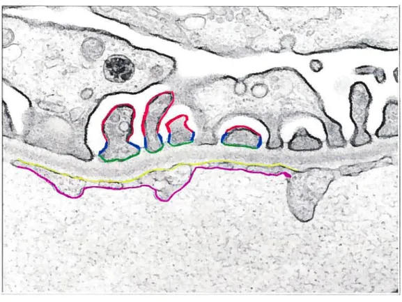 FIGURE 4: Dïssected areas of the glomerular walI for morphometrical evaluation. The plasma membrane surfaces of the glomerular wall were virtually separated into five distinct regions to facilitate morphometncal analysis: the abluminal (red) and luminal (g