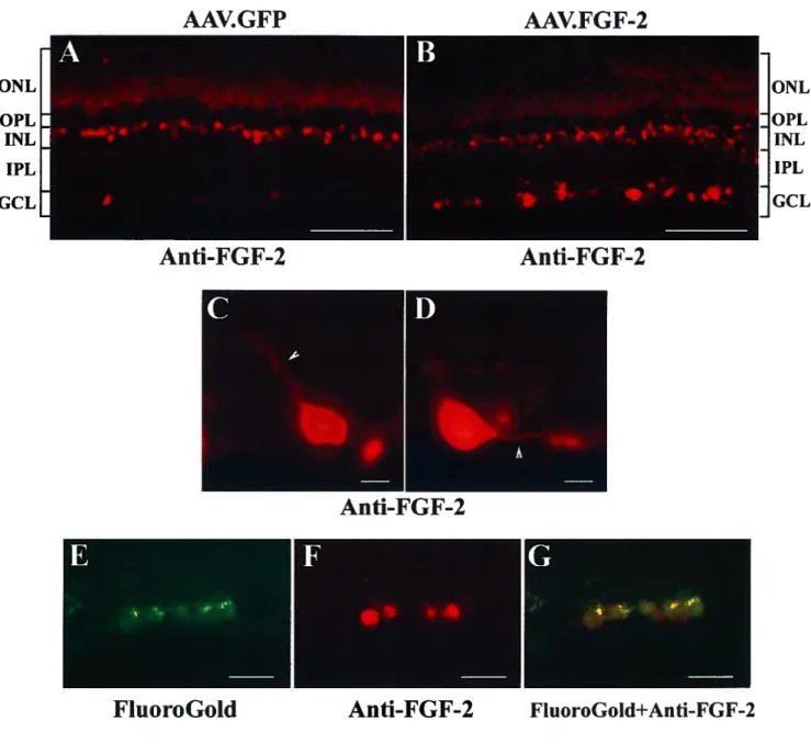 FIGURE 2. ONL OPL INL IPL GCL AAV.GFP AAV.fGF-2 Anti-FGF-2 Anti-FGf-2 Anti-fGF-2