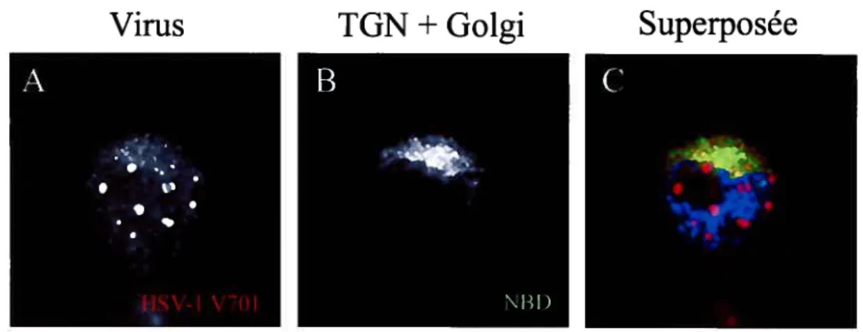 Figure 12: Colocalisation des capsides avec un second marqueur du TGN, le NBD. Les cellules 143B ont été infectées avec le virus HSV-1 V701 pour 7h à 39°C suivi de 6h à 20°C