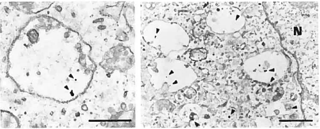 figure 10: Microscopie électronique de l’AMF intemalisé dans un corps multivésiculaire