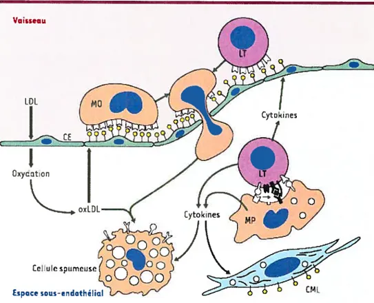 Figure 1.3- Athérogénêse 24 (LDL: lipoprotéines de basse densité; oxLDL : LUE oxydées; CE cellules endothéliales; MO: monocytes; ET: lymphocytes T; MP: