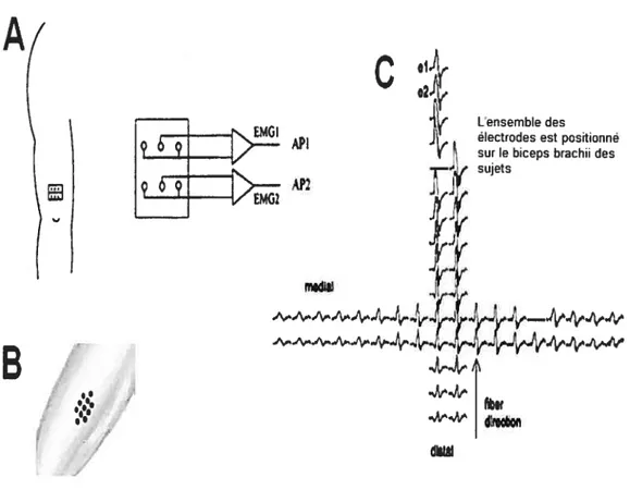 Fig. 2. 4 Formes des matrices d’électrodes utilisées par A) Christova et al. 171 B) Hogrel et al