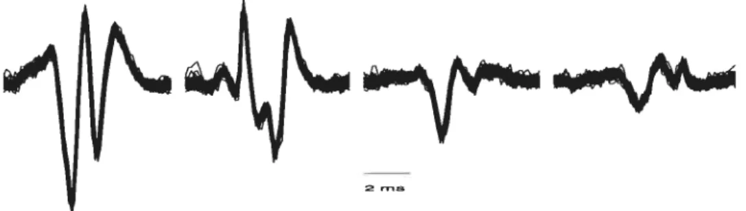 Figure 2.5 — Catégorisation de PAUMs extraits du signal de la Fig. 2.2.