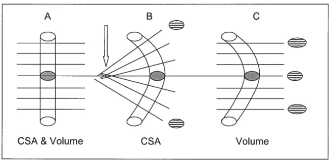 Fig. 3.10: Disposition des tranches IRM pour calculer le volume (C) et la CSA (B) des muscles du dos
