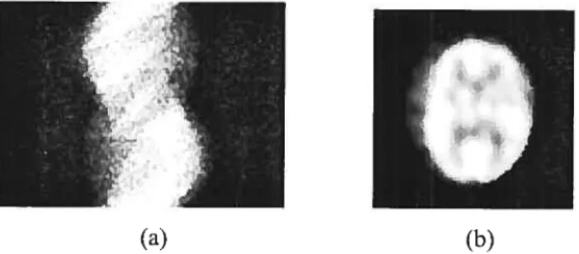 Figure 6: (a) The collection of Radon transforms of a braïn slice at ail angles. (b) A suce of a brain SPECT image.