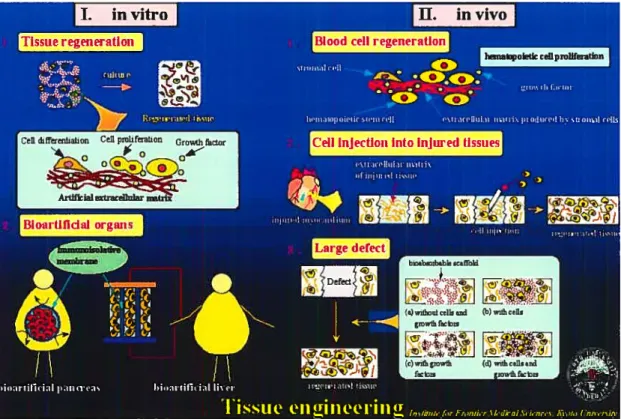 Figure 2 : Schéma définissant les deux grandes approches propres au génie tissulaire, soit la composante lit vitro (I), ainsi que celle lit vivo (II)