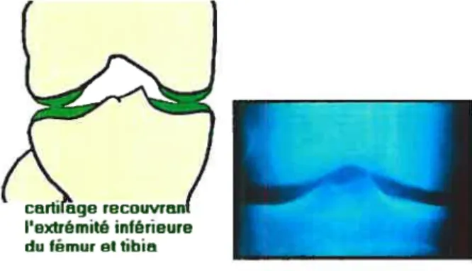 Figure 11 : Schéma et radiographie à rayons-X d’un genou normal’8