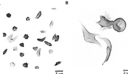 Figure 13 Globules rouges drépanocytaires présentant des anomalies de la forme, à différents agrandissements, v-us par microscopie électronique à ba1ayage36.