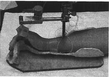 Figure 4: Mécanomyographie. La main est positionnée dans un support spécifique doté d’un capteur de force (métallique)