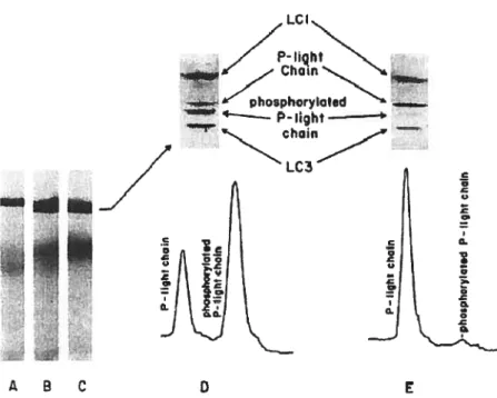 Figure 7: Phosphorylation des chaînes légères de la myosine. La figure montre l’isolation et la quantification des chaînes légères de la myosine dans un muscle squelettique