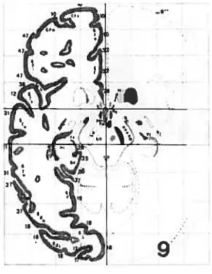 FIG. 5.2 - Talairacli. FiG. 5.3 Talairach estimé.