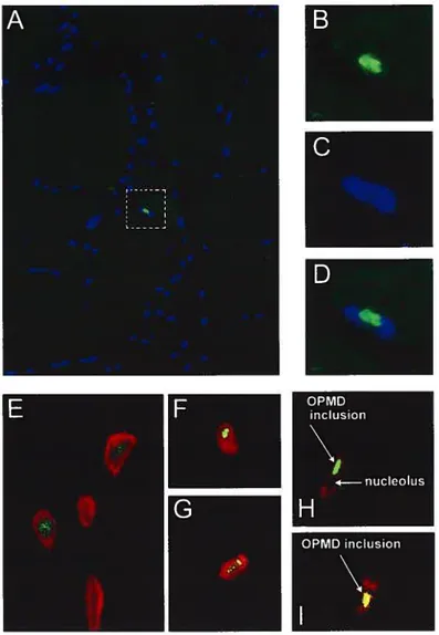 Figure 2 : Composition des inclusions intranucléaires de la DMOP. A —