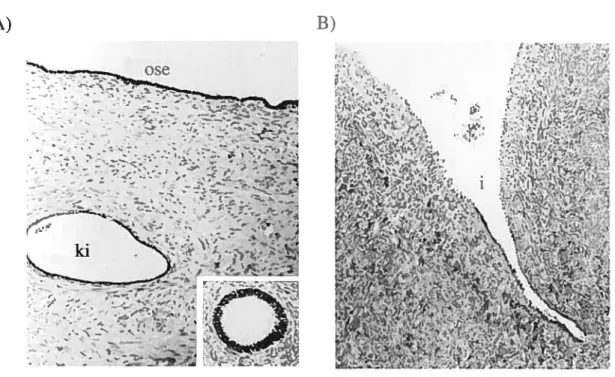 Figure 6 Coupes histologiques représentant l’épithélium de surface ovarien, une inclusion kystique et une invagination de l’OSE (tirée de [26, 36J)