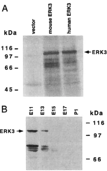 Fig. 3: Mouse ERK3 is a unique protein of 100 kDa. A) In vitro translation ofmouse ERK3 cDNA