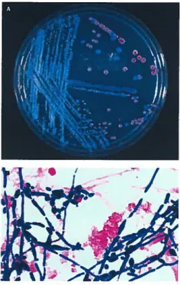 Figure 1-2: Observation macroscopique et microscopique du C. albicans. A, colonies de C