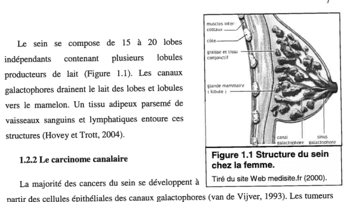 Figure 7.2 Les différents stades du carcinome canalaire.