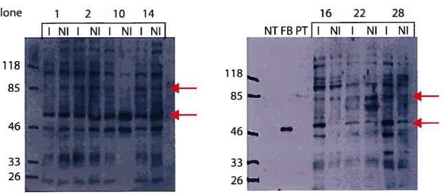 Figure 4 : Immuno-buvardages des clones ecdysone KBP2-flag avec et sans induction