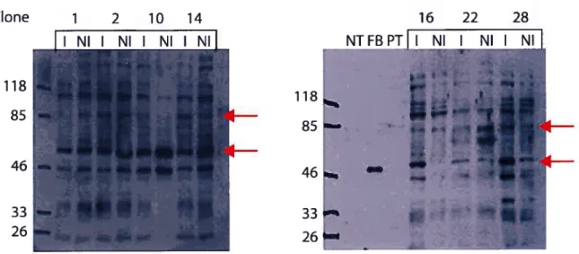 Figure 4 : Immuno-buvardages des clones ecdysone KBP2-flag avec et sans induction