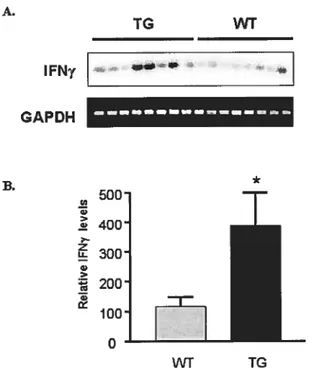 Figure 3.3. Expression cf IFNy in GC-Iransgenic mice. (A) Semi-quantitative RT-PCR was performed on Ieft ventricles (LV) cf the GC Transgenic (TG) and wild type (WT) mice using primers specific for IFNy and GAPDH (as a loading ccntrol) (B) Quantification c