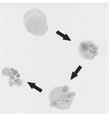 Figure 2: Le destin d’une cellule en culture (Namaiwa) exposée à l’étoposide. La cellule adopte une morphologie arrondie et contractée