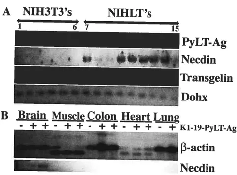 Figure 2 A NIH3T3’s NIHLT’s PyLT-Ag Necdin ‘Transgelin Dolix B Brain Muscle Colon Heart Lung
