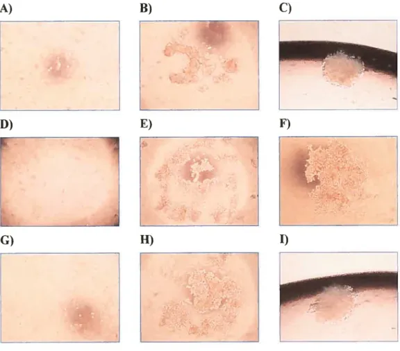 Figure 3 Apparence morphologique du développement des sphéroïdes en gouttelettes inversées