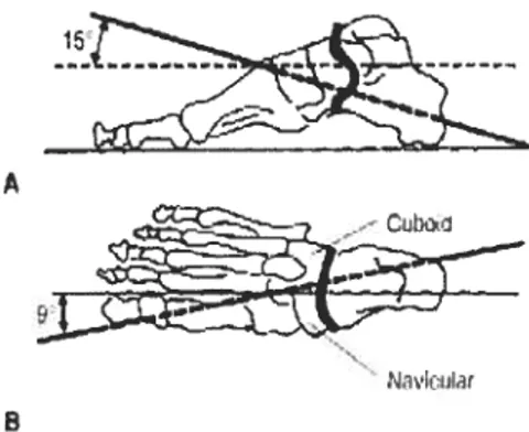Figure 7.3 Longitudinal axis of the transverse tarsal joint. A, Lateral view. B, Top view (Manter 7947)