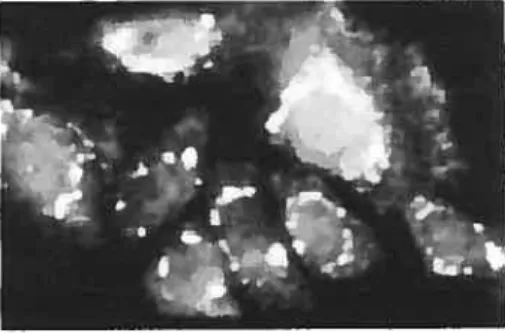 Figure 3. Immunofluorescence «ADRP effectuée sur des
