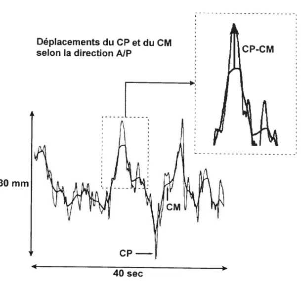 figure 2 : Déplacements du C’? et du C’M selon I axe A/P pour une durée de 40 s. L ‘encart permet de