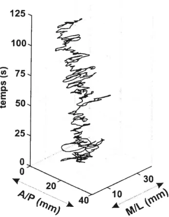 figure 4 Déplacements du C? selon les axes A/P et M/L et au cours du temps (120 s)