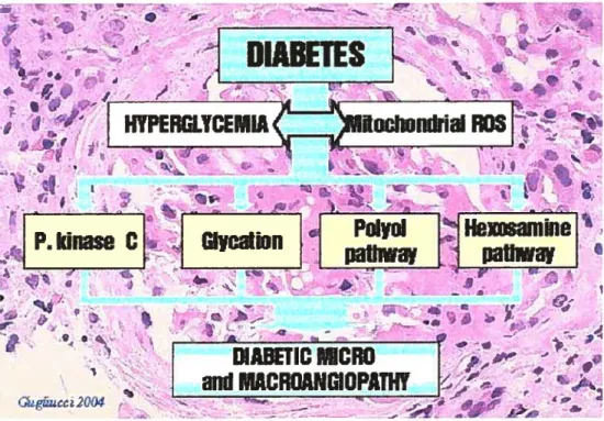 Figure 1: Four main pathways implicated in hyperglycemia-induced diabetic microvascular disease