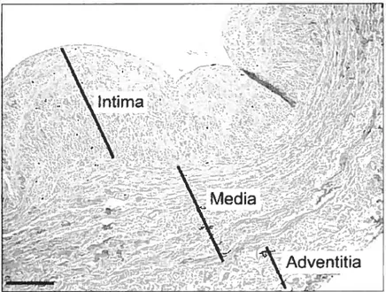 Figure 2: Vein wall with the intima underlying the endothelium, the media and the adventitia Scale bar is 200 p.m (44).
