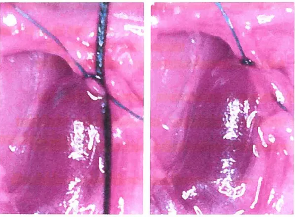 Figure 6: Rat inferior vena cava (IVC) stenosis mode! of venous thrornbosis (58). A severe stenosis was produced in the vein by tying a 5-0 silk suture around the vena cava to include the prolene suture in the right panel