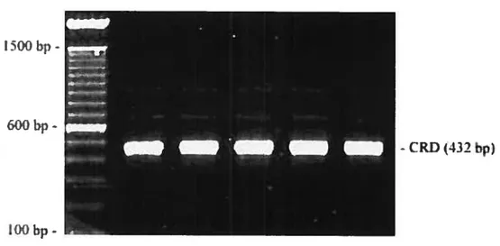 figure 6 Amplification de la séquence nucléotidique du CRD à partir du vecteur plcrHisA gal-3