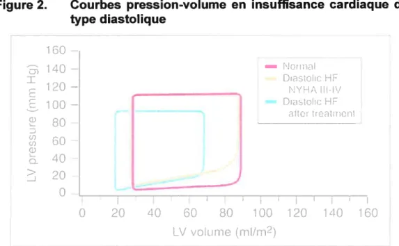Figure 2. Courbes pression-volume en insuffisance cardiaque de type diastolique 80 D 60 w 40 20 o