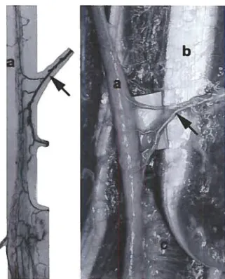 Fig. 6. Angiogram of the quadriceps tendon and patellar liga ment. Note thevasculararcades atthejunction ofthe quadriceps