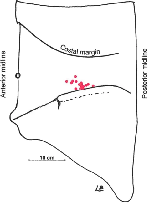 Figure 1. Distribution ofDCIA perforators along the iliac crest.