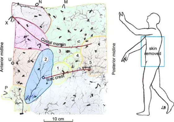 Figure 2. The DCIA cutaneous angiosome. Note angiosomes in close proximity to the DCIA in this cutaneous specimen ofthe left flank prepared with the whole body lead oxide and gelatine technique
