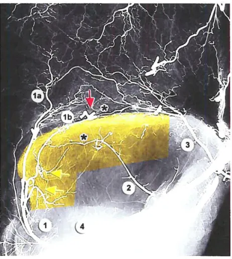 Figure 3. Contribution of the DCIA to the iliac crest. Angiogram ofthe flank area with skin, peritoneum, iliacus, and internai organs removed