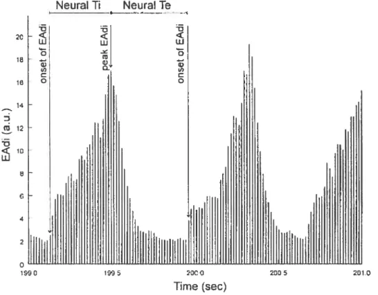 Figure 1. Neural Ti was arbitrarily defined as the difference in time