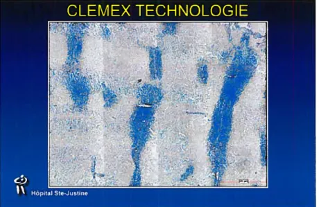 Figure 6: Clemex Technologies I Collagen I &amp; li (vert I green)