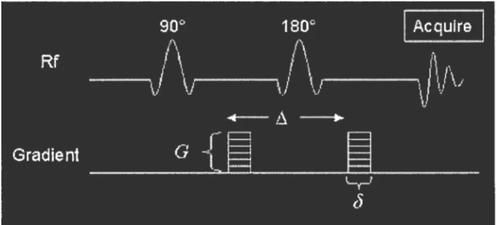Figure 6. Séquence d’impulsions utilisée en imagerie pondérée par diffusion.