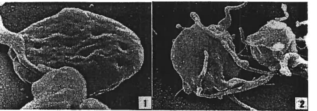 Figure 1: Images par microscopie électronique à balayage d’une plaquette au repos (1) et activée (2)